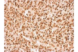 IHC-P Image APE1 antibody [N1], N-term detects APEX1 protein at nucleus on Saos2 xenograft by immunohistochemical analysis. (APEX1 抗体  (N-Term))