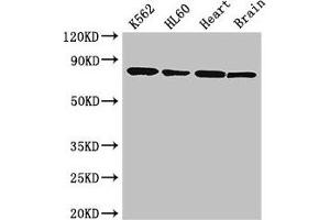 Western Blot Positive WB detected in: K562 whole cell lysate, HL60 whole cell lysate, Mouse heart tissue, Mouse brain tissue All lanes: BTK antibody at 3. (BTK 抗体  (AA 254-443))