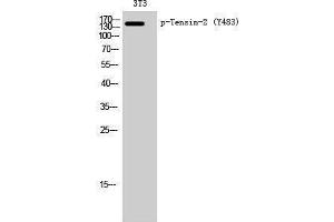 Western Blotting (WB) image for anti-Tensin Like C1 Domain Containing Phosphatase (Tensin 2) (TENC1) (pTyr483) antibody (ABIN3172982) (TENC1 抗体  (pTyr483))
