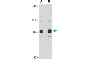Western blot analysis of SNPH in rat brain tissue lysate with SNPH polyclonal antibody  at (A) 1 and (B) 2 ug/mL . (Syntaphilin 抗体  (Internal Region))