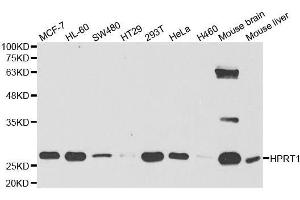 Western blot analysis of extracts of various cell lines, using HPRT1 antibody. (HPRT1 抗体  (AA 1-218))