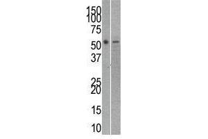Image no. 1 for anti-RuvB-Like 2 (E. Coli) (RUVBL2) (C-Term) antibody (ABIN357238)