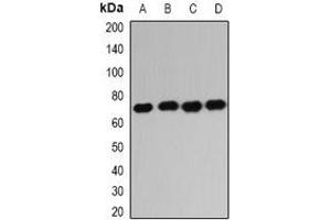 Western blot analysis of IGF2BP1 expression in HL60 (A), K562 (B), NIH3T3 (C), mouse liver (D) whole cell lysates. (IGF2BP1 抗体)