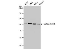 WB Image alpha Actinin 3 antibody detects alpha Actinin 3 protein by western blot analysis. (ACTN3 抗体  (Center))