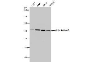 WB Image alpha Actinin 3 antibody detects alpha Actinin 3 protein by western blot analysis.