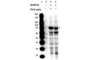 Image no. 1 for anti-MAP/microtubule Affinity-Regulating Kinase 2 (MARK2) (Isoform A), (pThr595) antibody (ABIN401318) (MARK2 抗体  (Isoform A, pThr595))