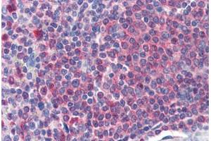 Human Spleen (formalin-fixed, paraffin-embedded) stained with CAT antibody ABIN364408 at 2 ug/ml followed by biotinylated anti-goat IgG secondary antibody ABIN481715, alkaline phosphatase-streptavidin and chromogen. (Catalase 抗体  (AA 498-511))