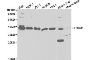 Western Blotting (WB) image for anti-Excision Repair Cross Complementing Polypeptide-1 (ERCC1) antibody (ABIN1876479) (ERCC1 抗体)