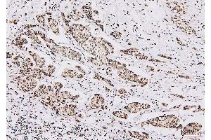 IHC analysis of NRF1 using anti-NRF1 antibody (ABIN7600874).