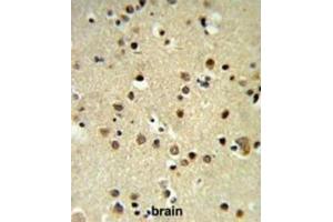 Immunohistochemistry (IHC) image for anti-Chromobox Homolog 1 (CBX1) antibody (ABIN3003963) (CBX1 抗体)