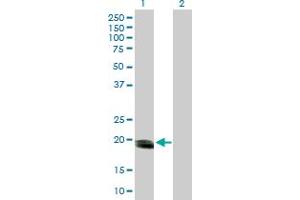 Western Blot analysis of SMUG1 expression in transfected 293T cell line by SMUG1 MaxPab polyclonal antibody.
