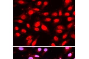 Immunofluorescence analysis of U2OS cells using U2AF2 Polyclonal Antibody (U2AF2 抗体)