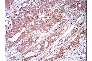 Immunohistochemistry (IHC) image for anti-Colony Stimulating Factor 1 Receptor (CSF1R) (AA 344-497) antibody (ABIN1724928)