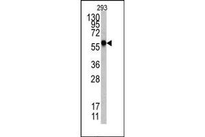 Image no. 1 for anti-Heat Shock Factor Protein 1 (HSF1) (Sumoylation Site) antibody (ABIN357730) (HSF1 抗体  (Sumoylation Site))