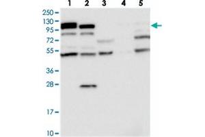 Western blot analysis of Lane 1: RT-4, Lane 2: U-251 MG, Lane 3: Human Plasma, Lane 4: Liver, Lane 5: Tonsil with OAS3 polyclonal antibody  at 1:250-1:500 dilution. (OAS3 抗体)