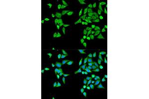 Immunofluorescence analysis of MCF-7 cell using CES2 antibody. (CES2 抗体  (AA 310-410))