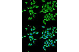 Immunofluorescence analysis of MCF-7 cell using CES2 antibody. (CES2 抗体  (AA 310-410))