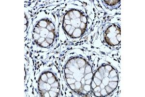 Immunohistochemistry (IHC) image for anti-TH1-Like (TH1L) (AA 355-599) antibody (ABIN1683024)