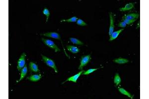 Immunofluorescent analysis of Hela cells using ABIN7161494 at dilution of 1:100 and Alexa Fluor 488-congugated AffiniPure Goat Anti-Rabbit IgG(H+L) (NCF1 抗体  (AA 63-232))