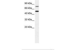 Image no. 1 for anti-Choroideremia-Like (Rab Escort Protein 2) (CHML) (AA 122-171) antibody (ABIN6735875) (CHML 抗体  (AA 122-171))