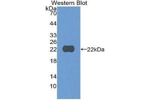 Western Blotting (WB) image for anti-Cylindromatosis (Turban Tumor Syndrome) (CYLD) (AA 170-338) antibody (ABIN3205178) (CYLD 抗体  (AA 170-338))