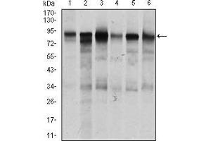 Western blot analysis using TGFBR3 mouse mAb against Jurkat (1), HeLa (2), MCF-7 (3), F9 (4), SK-N-SH (5), and NIH3T3 (6) cell lysate. (TGFBR3 抗体  (AA 147-328))