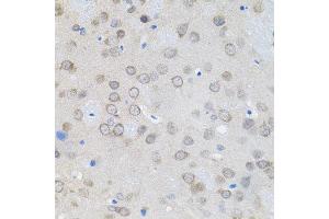 Immunohistochemistry of paraffin-embedded rat brain using UBE2A antibody. (UBE2A 抗体)