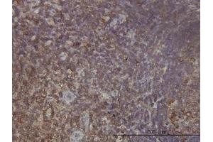 Image no. 1 for anti-Ribosomal Protein L9 (RPL9) (AA 93-192) antibody (ABIN598584) (RPL9 抗体  (AA 93-192))