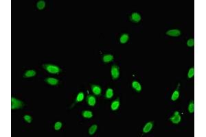Immunofluorescent analysis of Hela cells using ABIN7143861 at dilution of 1:100 and Alexa Fluor 488-congugated AffiniPure Goat Anti-Rabbit IgG(H+L) (Ensa 抗体  (AA 1-121))
