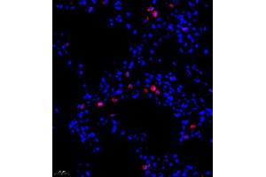 Immunofluorescence of paraffin embedded rat lung using ADI1 (ABIN7072888) at dilution of 1:1200 (400x lens) (ADI1 抗体)