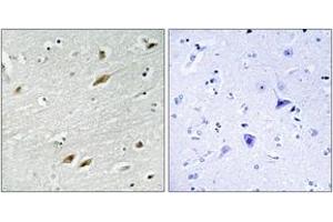 Immunohistochemistry analysis of paraffin-embedded human brain tissue, using FKHR (Ab-319) Antibody. (FOXO1 抗体  (AA 286-335))