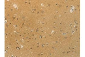 The image on the left is immunohistochemistry of paraffin-embedded Human brain tissue using ABIN7192532(SLC9A3 Antibody) at dilution 1/20, on the right is treated with synthetic peptide. (SLC9A3 抗体)