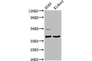 Western Blot Positive WB detected in: A549 whole cell lysate, Rat kidney tissue All lanes: LGALS12 antibody at 3 μg/mL Secondary Goat polyclonal to rabbit IgG at 1/50000 dilution Predicted band size: 38, 32, 37, 30, 36 kDa Observed band size: 38 kDa