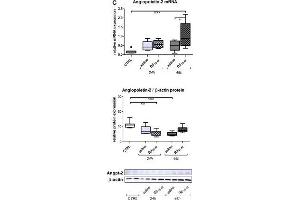Bβ15-42 favors angiogenesis. (Angiopoietin 2 抗体)