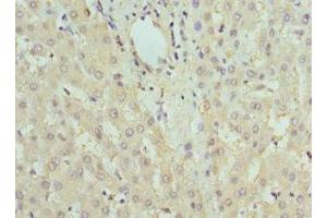 Immunohistochemistry of paraffin-embedded human liver tissue using ABIN7153202 at dilution of 1:100 (FBP1 抗体  (AA 1-338))