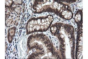 Image no. 5 for anti-Leucine Zipper and CTNNBIP1 Domain Containing (LZIC) antibody (ABIN1499239)