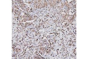 IHC analysis of HLA-DRA using anti-HLA-DRA antibody (ABIN7600948). (HLA-DRA 抗体  (AA 26-254))