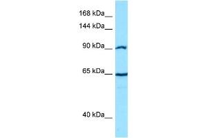 Host: Rabbit Target Name: CTNNA2 Sample Type: PANC1 Whole cell lysates Antibody Dilution: 1. (CTNNA2 抗体  (C-Term))