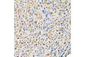 Immunohistochemistry of paraffin-embedded rat ovary using RBBP9 Rabbit pAb (ABIN6129095, ABIN6146752, ABIN6146753 and ABIN6220638) at dilution of 1:200 (40x lens). (RBBP9 抗体  (AA 1-186))