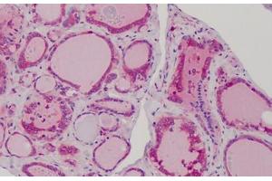 Human Thyroid: Formalin-Fixed, Paraffin-Embedded (FFPE) (MAD2L1 抗体  (AA 1-174))