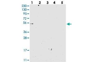 Western blot analysis of Lane 1: RT-4, Lane 2: U-251 MG, Lane 3: Human Plasma, Lane 4: Liver, Lane 5: Tonsil with MKS1 polyclonal antibody . (MKS1 抗体)