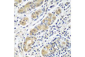 Immunohistochemistry of paraffin-embedded human stomach using GPRC5A antibody at dilution of 1:100 (40x lens). (GPRC5A 抗体)