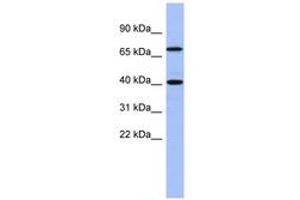 Image no. 1 for anti-SLAIN Motif Family, Member 2 (SLAIN2) (AA 71-120) antibody (ABIN6743288) (SLAIN2 抗体  (AA 71-120))