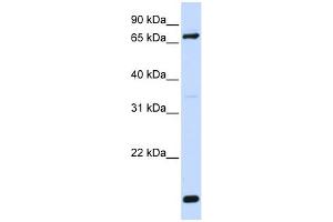 WB Suggested Anti-ACSL4 Antibody Titration: 0.