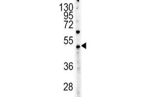 c-Myc antibody western blot analysis in HeLa lysate (Myc Tag 抗体  (AA 408-439))