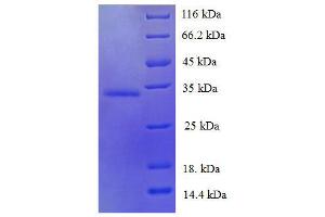 Trefoil Factor 1 (TFF1) (AA 25-84) protein (His tag) expressed in E.