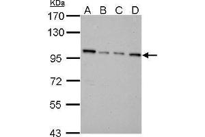 WB Image NNT antibody detects NNT protein by Western blot analysis. (NNT 抗体  (C-Term))