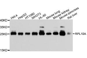 Western blot analysis of extracts of various cell lines, using RPL10A antibody. (RPL10A 抗体  (AA 1-110))
