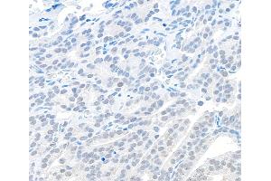 Immunohistochemistry (IHC) image for anti-Chromosome 11 Open Reading Frame 30 (C11orf30) (C-Term) antibody (ABIN7454601) (EMSY 抗体  (C-Term))