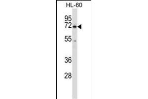 BTK Antibody (N-term) (ABIN657469 and ABIN2846497) western blot analysis in HL-60 cell line lysates (35 μg/lane). (BTK 抗体  (N-Term))